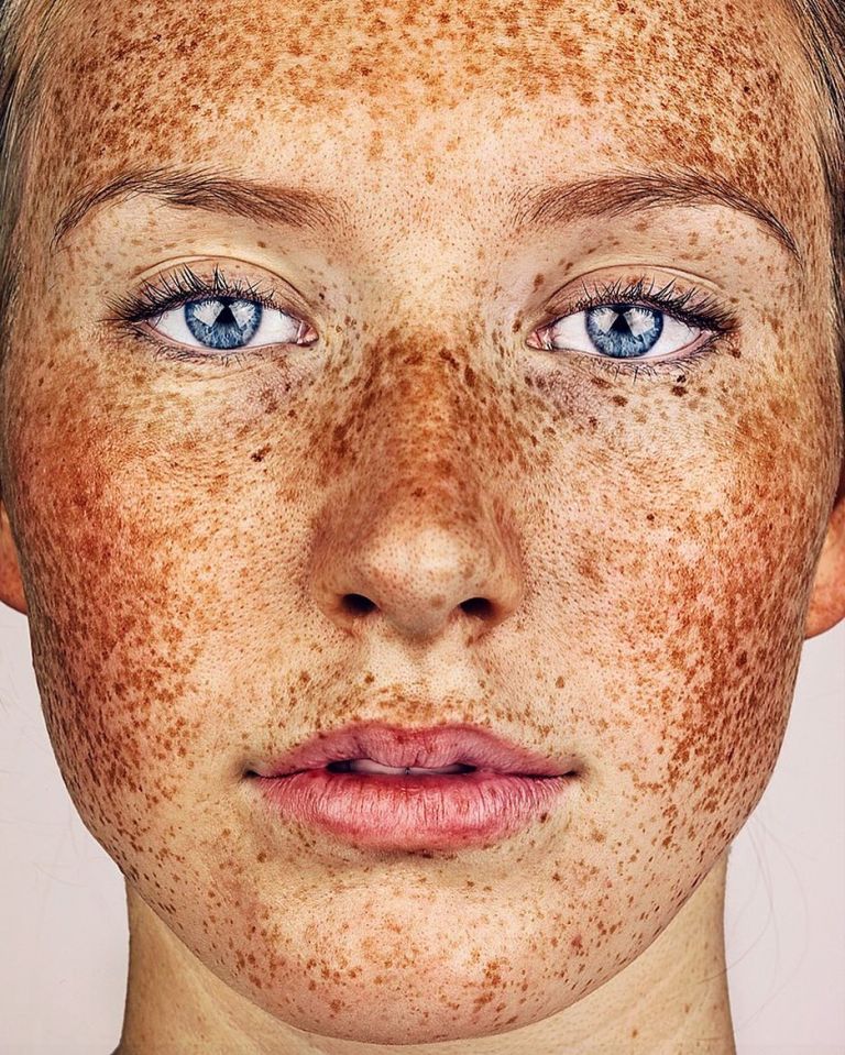 La Beaut Unique Des Taches De Rousseur Mis En Valeur Par Un Photographe Tuxboard