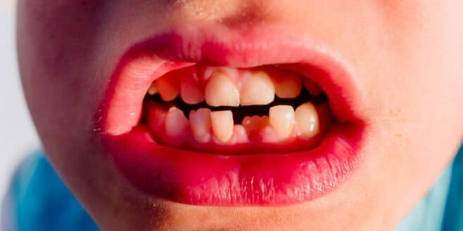 Signification des rêves ça veut dire quoi si je rêve de perdre mes dents