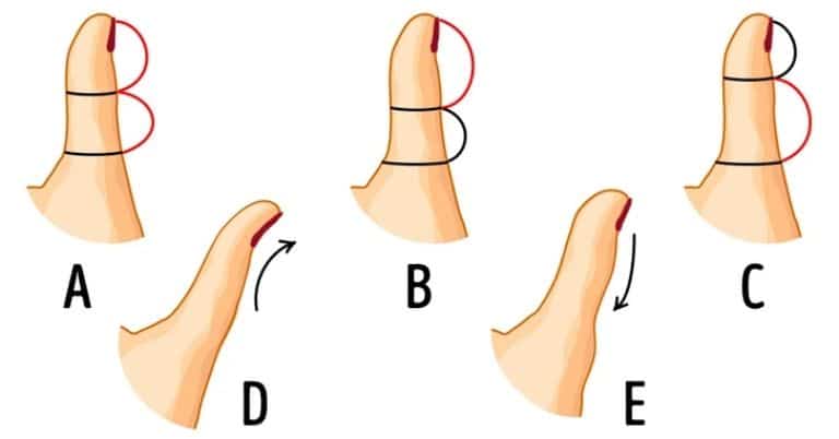 Test de personnalité: la forme de votre pouce dévoile un secret sur votre façon d'être