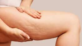 La cellulite c'est fini avec cette plante aux propriétés magiques