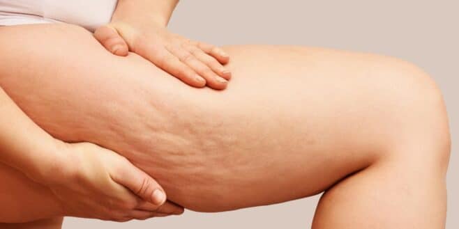 La cellulite c'est fini avec cette plante aux propriétés magiques